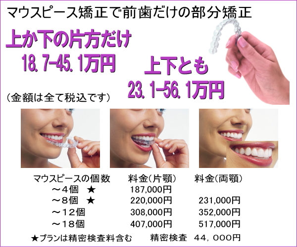 マウスピース矯正で前歯だけの部分矯正